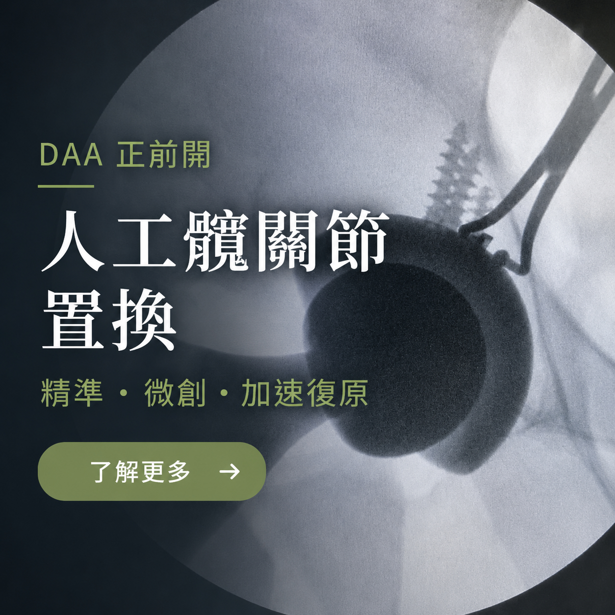 首頁 9 51a57e583c4dd2f52ecc7c77244ea07f6460565bcd6df17ede2773ec92372e21