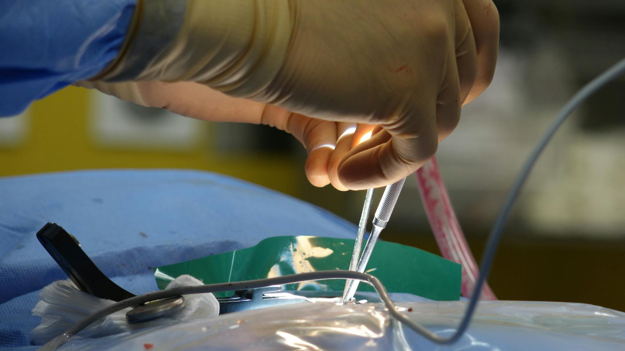 首頁 2 close up of a surgeons hands performing an
