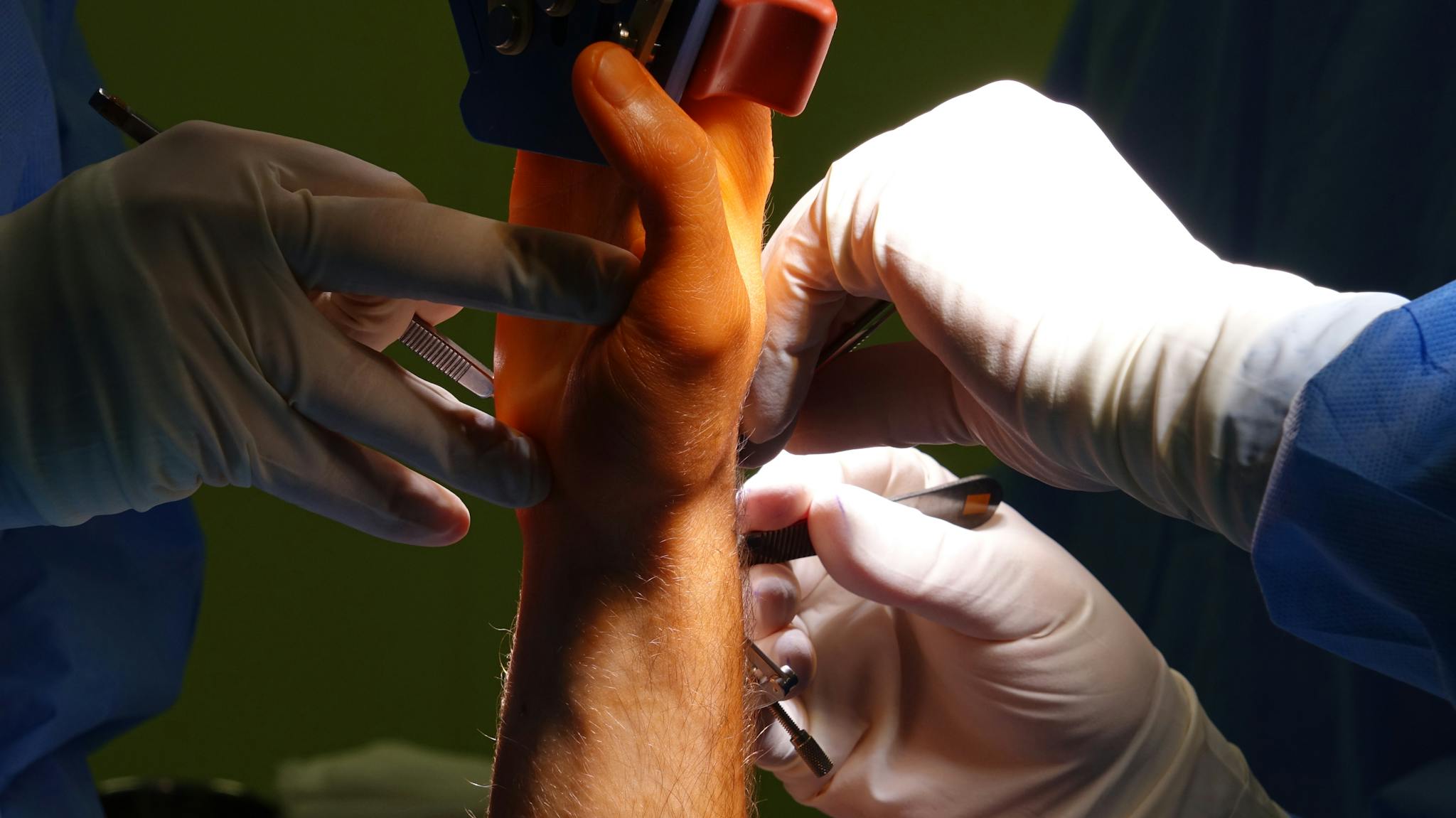 首頁 4 detail shot of a surgical procedure on