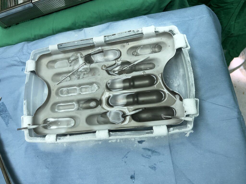 什麼是冷凍治療? 3 IMG 9644 1